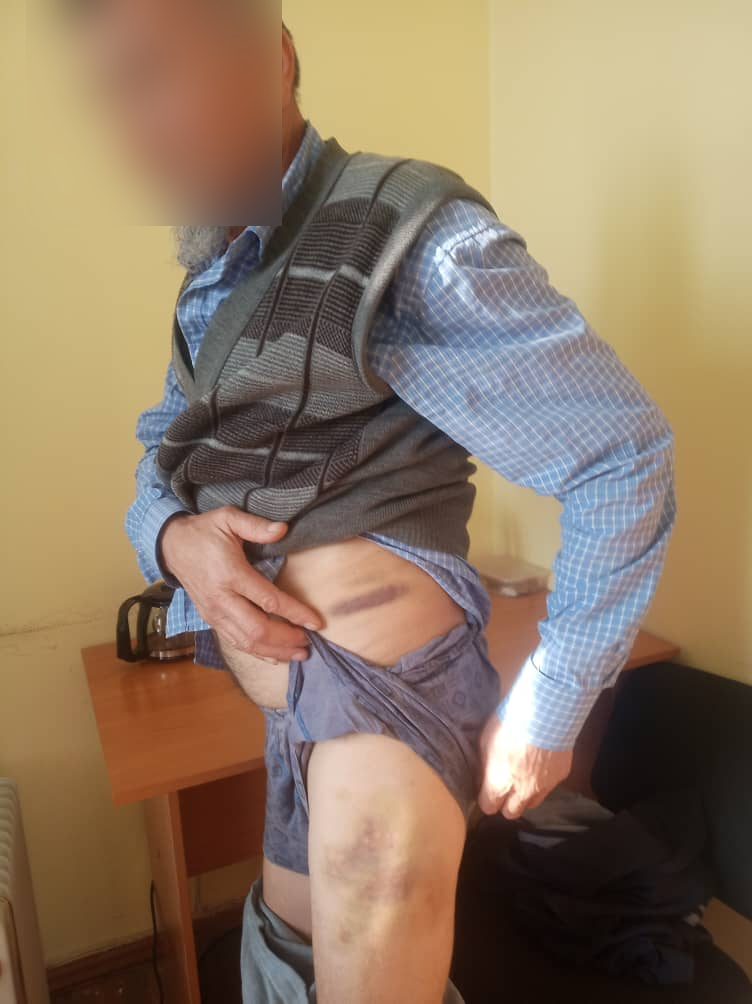 3 Пенсионер-инвалид заявил, что милиционеры в Узгене его избили и угрожали сексуальным насилием. Фото