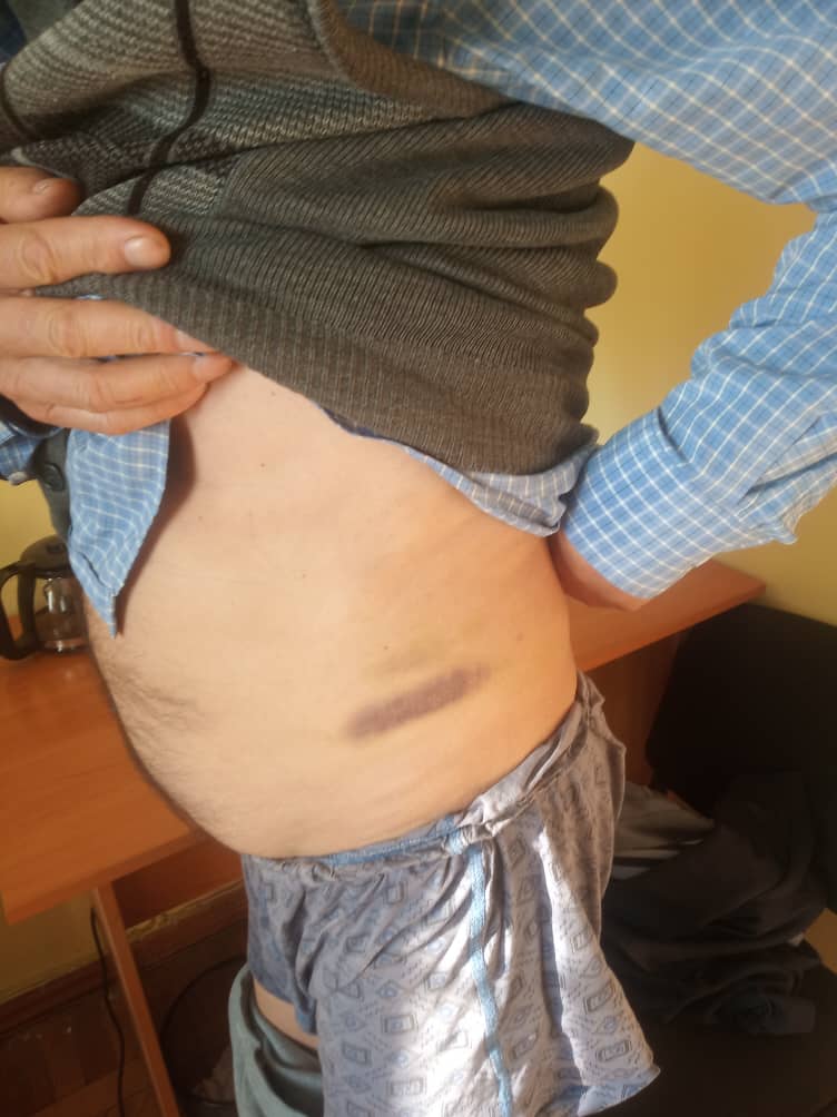 8 1 Пенсионер-инвалид заявил, что милиционеры в Узгене его избили и угрожали сексуальным насилием. Фото
