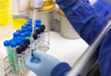 Кыргызстанда COVID-19 боюнча акыркы суткадагы статистика: 84 адам жугузуп, 2 адам көз жумду