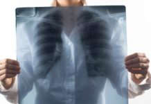 Дүйнөдө COVID-19 пандемиясына байланыштуу кургак учуктан өлгөндөр көбөйдү