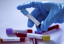 Статистика по COVID: 193 новых случая заражения, за сутки умерли двое