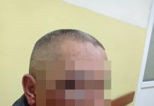 Интернеттен жол тескөөчүнүн бети канжалаган сүрөтү жарыяланды