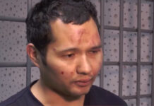 Переломы ребер, ушибы, сотрясение: Викрам Рузахунов рассказал о травмах после избиения силовиками в Алматы