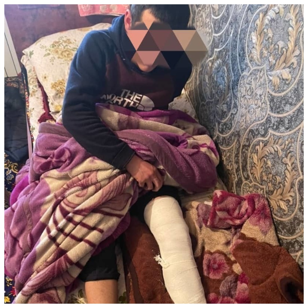 MyCollages 44 В Ошской области директор школы избил ученика и сломал ему ногу