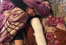 Сломавший ногу ученику директор школы уволился