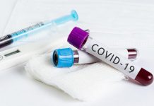 COVID-19 боюнча статистика: Акыркы суткада 198 адамдан табылып, бир бейтап каза болду