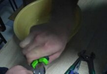 Колуна шакекти чыгара албай калган балага жардам берилди