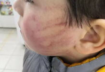 Сокулуктагы 2 жаштагы баланы апасы катуу сабаган