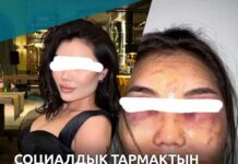 Бишкекчанку жестоко избил муж-турок. Он в розыске