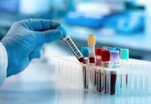 Жеке медициналык лабораториялардын ишмердүүлүгүндөгү коррупция аныкталды