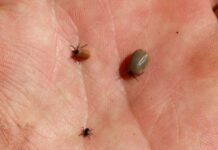 В Бишкеке за майские праздники к медикам с укусами клещей обратились 57 человек