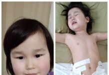 Беш жаштагы кызыбызга жардам керек! Оң бөйрөгү соолуп калган, сол бөйрөгү кичирейип баратат