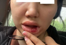 Бишкекчанку возле банкомата избил незнакомец. Милиция его отпустила