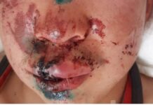 Карындашын коргойм деп катуу сабалган баланын окуясы ИИМдин жетекчилигинин жеке көзөмөлүндө