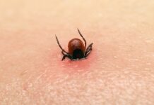 Более 300 человек обратились с укусами клеща в Бишкеке, выявлено 5 случаев энцефалита