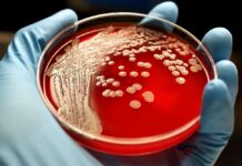 В Кара-Бууре у двух жителей выявили сибирскую язву