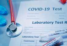 COVID-19: Кыргызстанда акыркы суткада 91 жаңы учур катталды