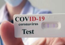 Соңку суткада СOVID-19 инфекциясынын 28 учуру аныкталды