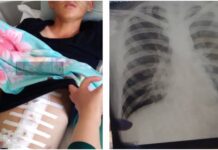 Избили до разрыва мочевого пузыря. Дело об избиении 20-летнего солдата прекращено