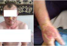 В Каинды мужчина ограбил и поджег местного жителя