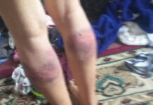 Подозреваемого в жестоком избиении жены отпустили под домашний арест. Женщине угрожают