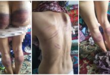 Суд отпустил под домашний арест тирана, жестоко избивавшего жену