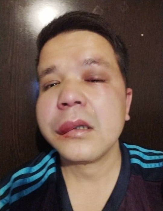 4156f3b9 a63a 4d93 966b bec79d00f7a0 В Бишкеке четверо мужчин избили журналиста SuperTV Бактурсуна Жоробекова