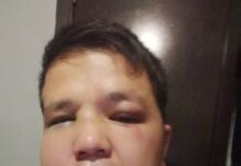 SuperTV’нын сабалган кабарчысы ооруканага жаткырылды