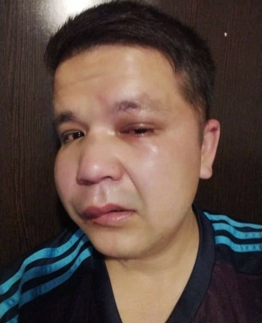 8d057e3e 47d9 4f32 901b ed7c618c1224 В Бишкеке четверо мужчин избили журналиста SuperTV Бактурсуна Жоробекова