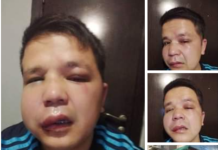 SuperTV’нын кабарчысы Бактурсун Жоробеков 4 белгисиз жаран тарабынан сабалды