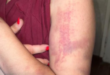 Жительница Оша заявила, что ее избили и пытали сотрудники УВД