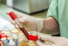 Бишкекте 155 тургун канын акысыз текшертти