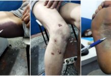 «Избивали, изнасиловали дубинкой». Сотрудников РОВД обвинили в пытках