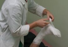 Бишкекте катуу сууктан бутунун манжаларын үшүккө алдырган адам ооруканага жаткырылды