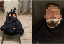 УКТнын мүчөлөрү арматура менен сабаган экинчи жаран да ооруканада көз жумду