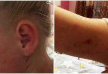 Прокуратура начала проверку по факту жестокого обращения с девочкой в детдоме в Оше