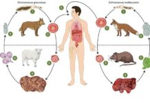 В Кыргызстане растет число заболевания эхинококкозом