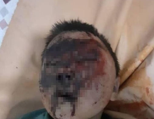 whatsapp image 2023 02 20 at 14 09 11 В Ноокате воспитанники медресе до комы избили 12-летнего мальчика