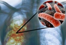 Кургак учукту айыктырса болот