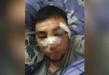 Абиров тарабынан ур-тепкиге алынган жарандын абалы канааттандырарлык