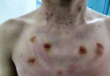 «Душили, угрожали изнасиловать дубинкой»: сотрудников милиции подозревают в пытках