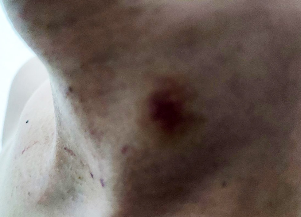 foto 3 "Душили, угрожали изнасиловать дубинкой": сотрудников милиции подозревают в пытках