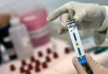 Бишкекчане смогут бесплатно провериться на ВИЧ, гепатиты В и С