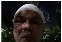 Бишкекте Канаданын жаранын сабап кетишти