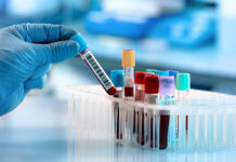 Кыргызстанцы могут бесплатно провериться на гепатиты В и С