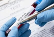 Кыргызстанда таажы вирусуна каршы вакцина сактоочу сегиз кампа курулат