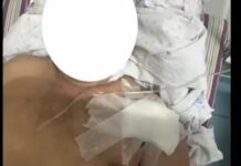 В Аламудунском районе двое парней напали с ножом на таксиста