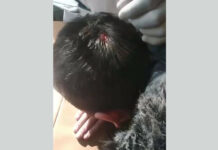 В Узбекистане учительница разбила голову пятикласснику, кинув в него телефоном