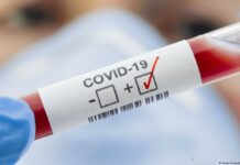 В Кыргызстане за неделю выявили 15 случаев COVID-19