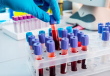 ️Крупные частные лаборатории Кыргызстана снизят до 30% цены на все исследования после совещания с ГКНБ